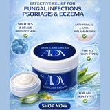 ADA Skin Care anti-fungal cream for eczema psoriasis and fungal infection treatment