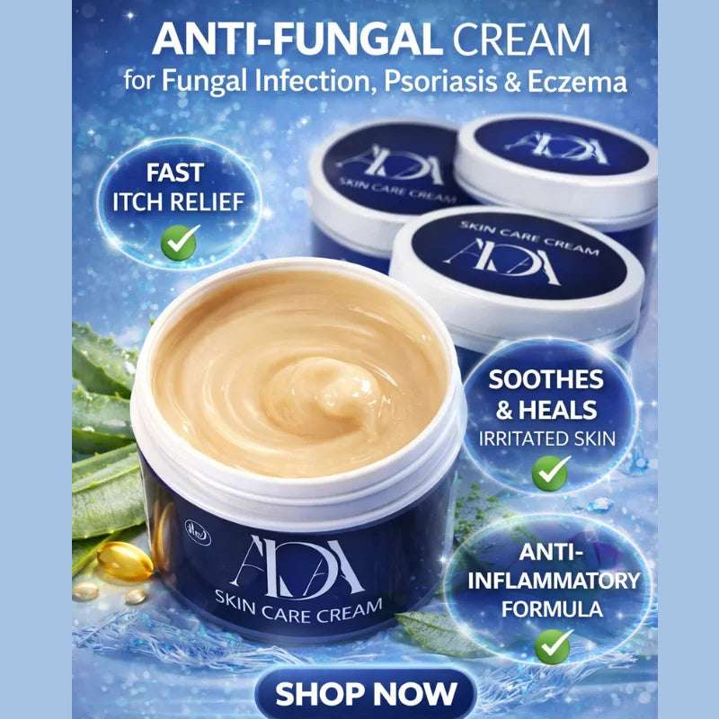 ADA Skin Care anti-fungal cream for eczema psoriasis and fungal infection treatment